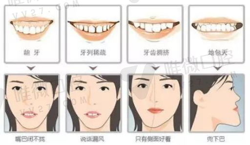 假牙上下的材质有什么区别,假牙有金属的或没有金属的区别(图1)